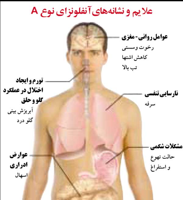 آنفولانزای خوکی یا آنفلوانزای H1N1