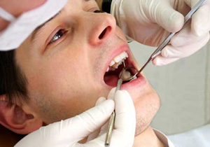 پوسیدگی دندان یک بیماری شایع در تمام کره زمین