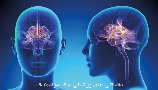 روشهای پیشگیری از سکته مغزی