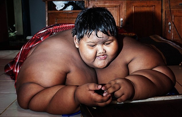 چاق ترین کودک جهان طی یک ماه 31 کیلو لاغر شد.