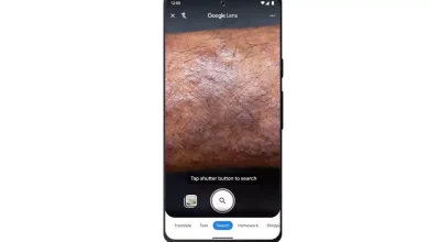 گوگل لنز اکنون می‌تواند بیماری‌های مختلف پوستی را تشخیص بدهد