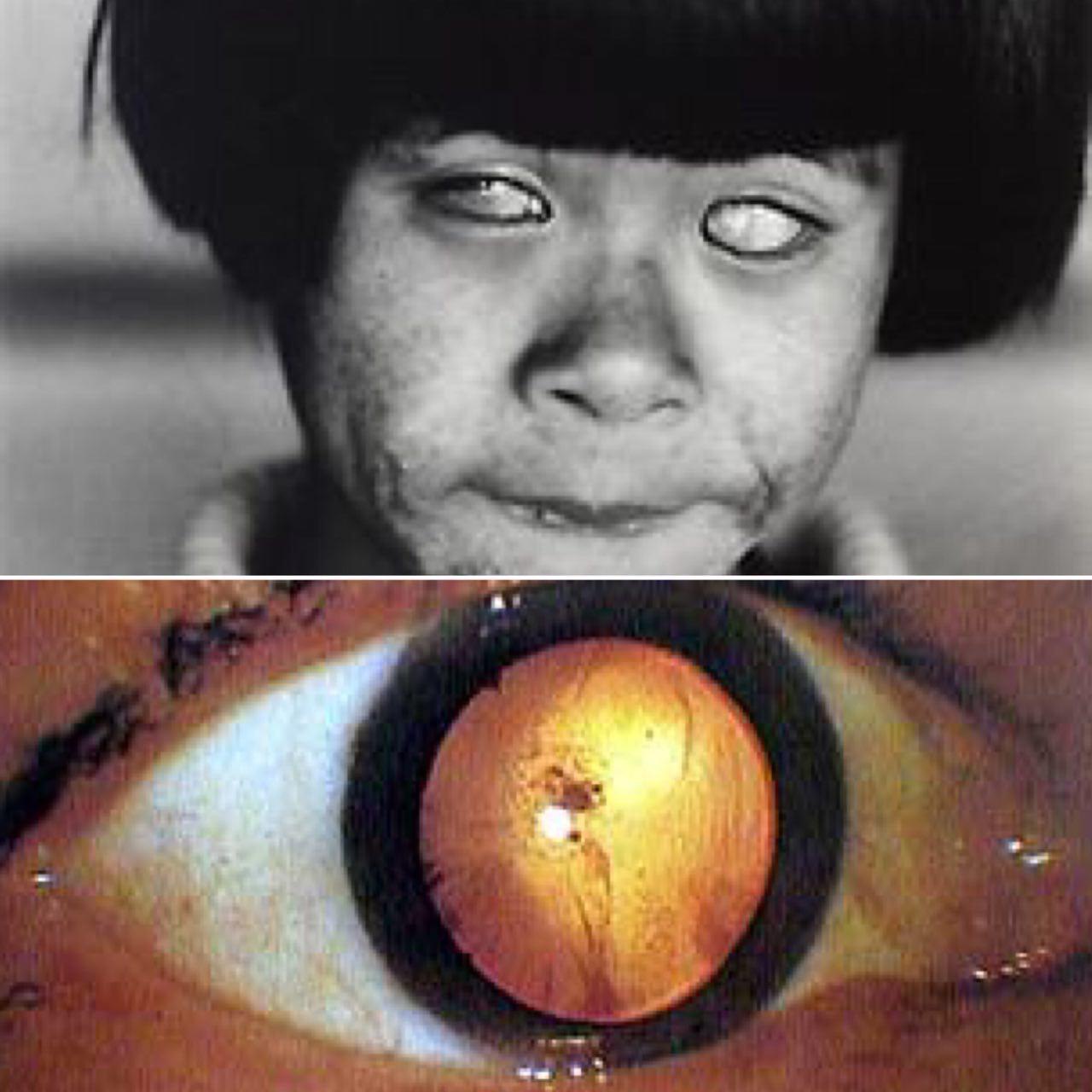 دخترِ در تصویر بالا جن یا هیولا نیست !