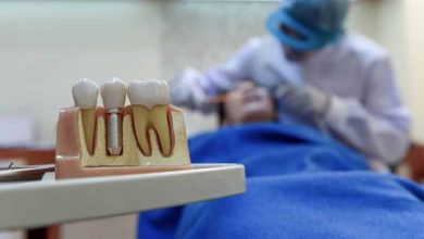 بهترنی مرکز ایمپلنت تهران