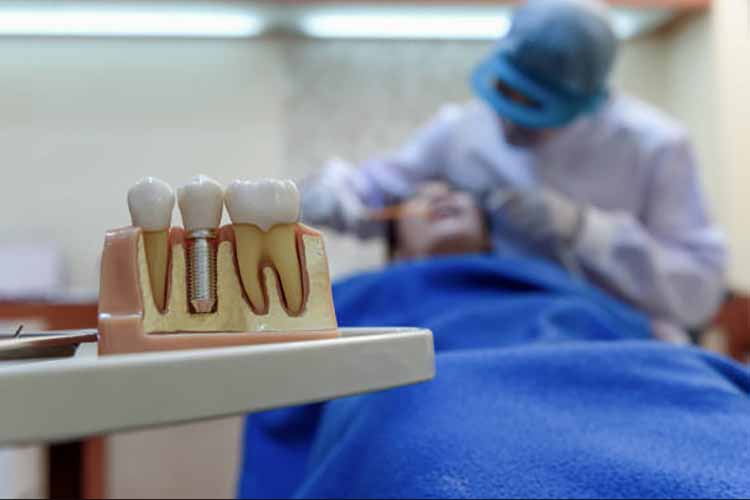 بهترنی مرکز ایمپلنت تهران