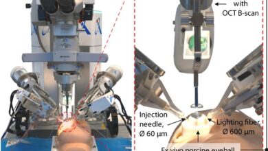 روبات و هوش مصنوعی جراح چشم شدند